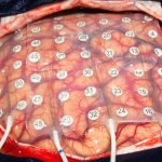 Science mag : Artificial intelligence turns brain activity into speech